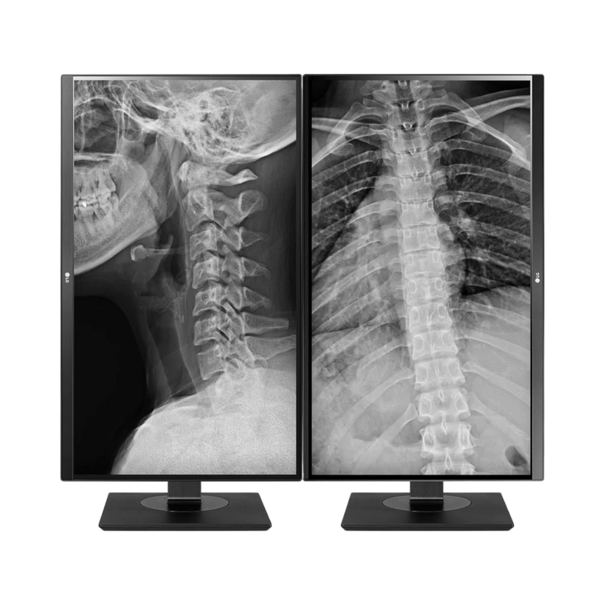 LG 27HJ713C 27" 16:9 60Hz 8MP 4K IPS Clinical Review Monitor — Being Shipped