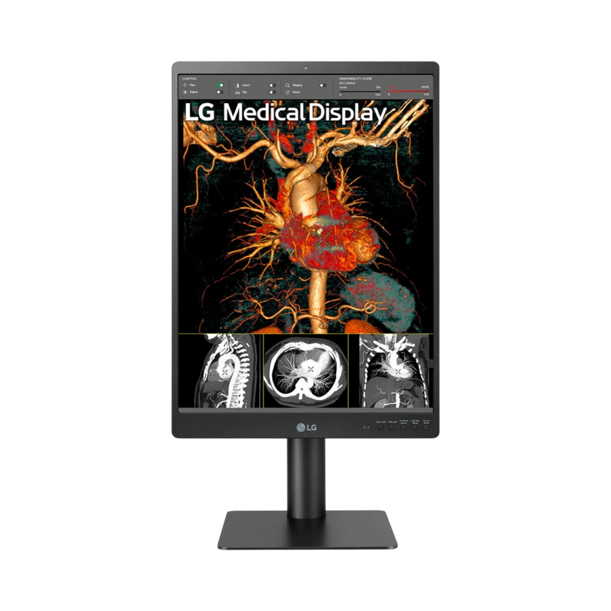 LG 21HQ613D-B 21" 4:5 60Hz 5MP IPS Diagnostic IPS Monitor — Being Shipped