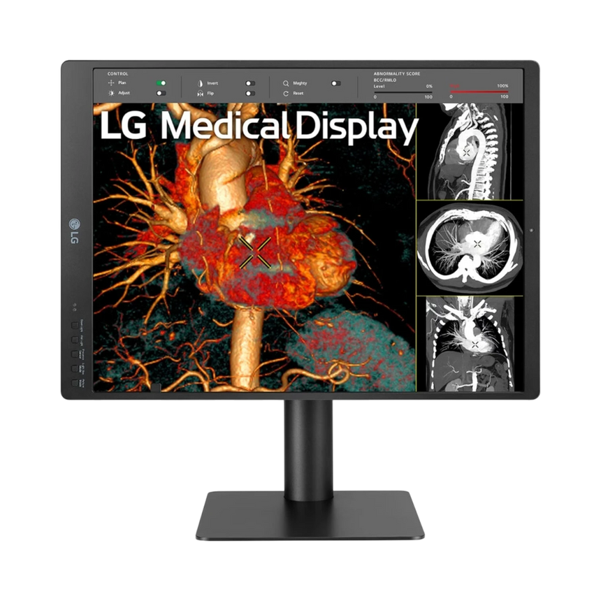 LG 21HQ613D-B 21" 4:5 60Hz 5MP IPS Diagnostic IPS Monitor — Being Shipped