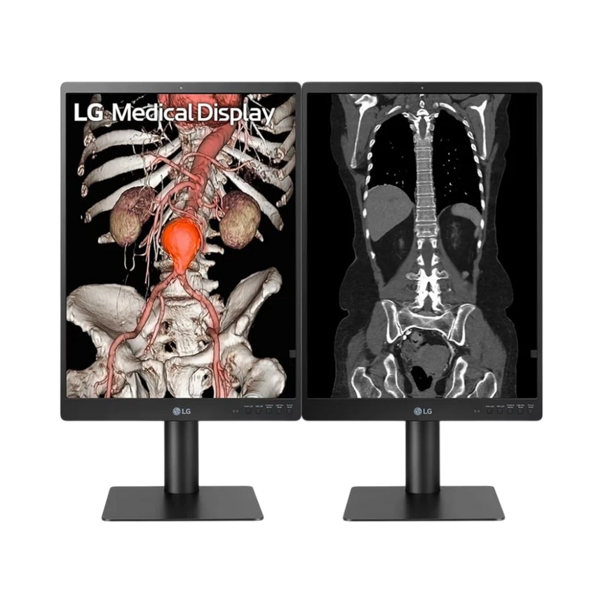 LG 21HQ513D 21.3" 3:4 60Hz 3MP IPS Diagnostic Monitor — Being Shipped