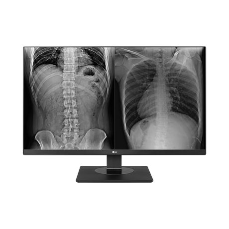 LG 27HJ713C 27" 16:9 60Hz 8MP 4K IPS Clinical Review Monitor — Being Shipped