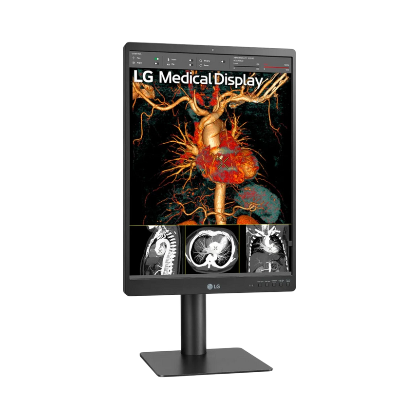 LG 21HQ613D-B 21" 4:5 60Hz 5MP IPS Diagnostic IPS Monitor — Being Shipped