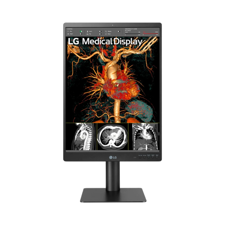 LG 21HQ613D-B 21" 4:5 60Hz 5MP IPS Diagnostic IPS Monitor — Being Shipped
