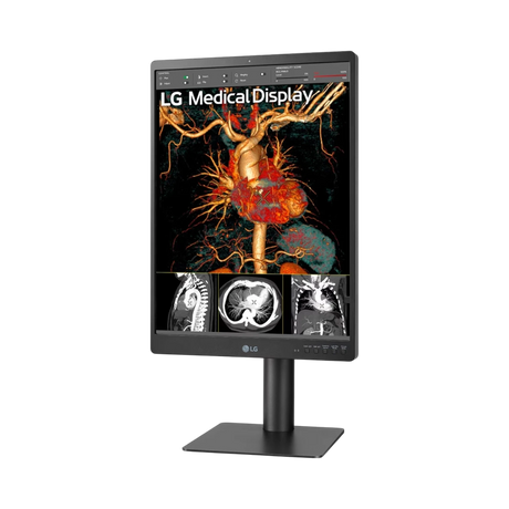 LG 21HQ613D-B 21" 4:5 60Hz 5MP IPS Diagnostic IPS Monitor — Being Shipped