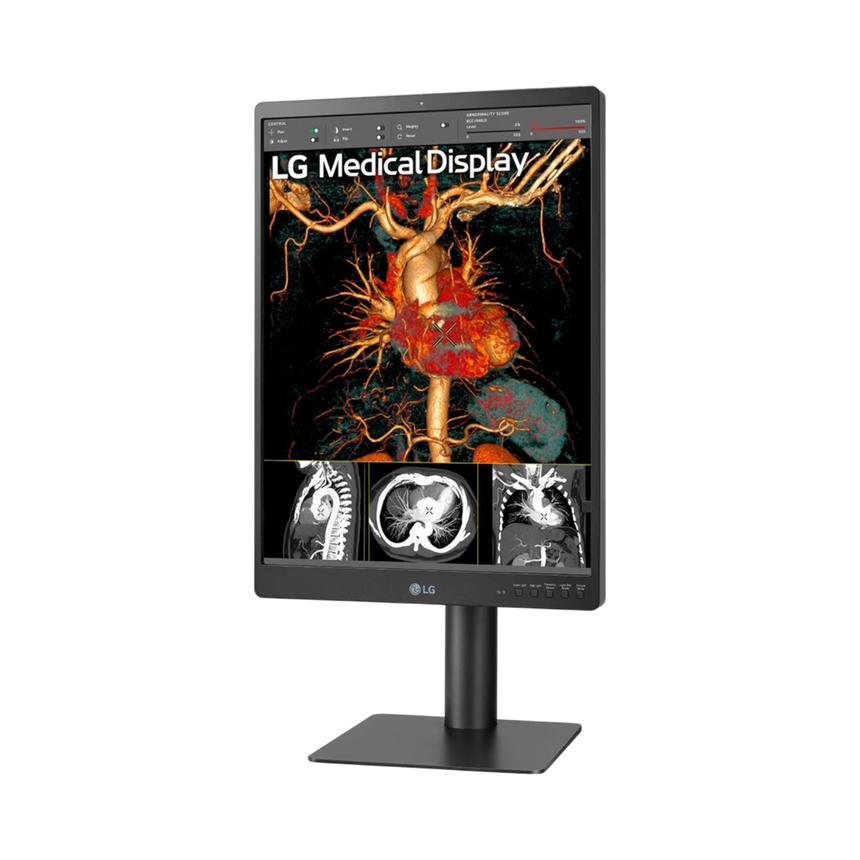 LG 21HQ613D-B 21" 4:5 60Hz 5MP IPS Diagnostic IPS Monitor — Being Shipped