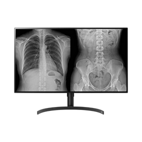 LG 32HL512D-B 31.5" 16:9 60Hz 8MP 4K HDR IPS Color Diagnostic Monitor — Being Shipped