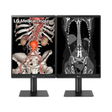 LG 21HQ513D 21.3" 3:4 60Hz 3MP IPS Diagnostic Monitor — Being Shipped