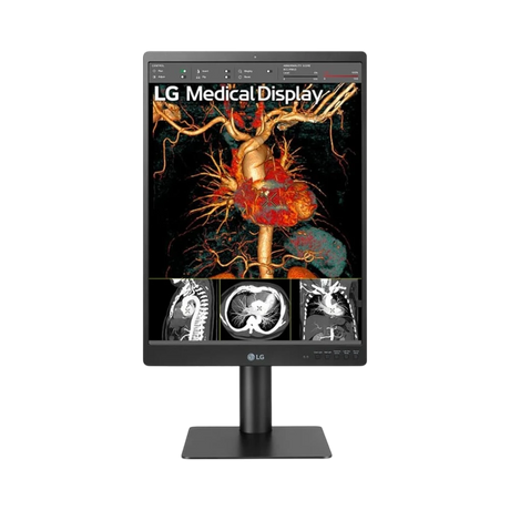 LG 21HQ513D 21.3" 3:4 60Hz 3MP IPS Diagnostic Monitor — Being Shipped