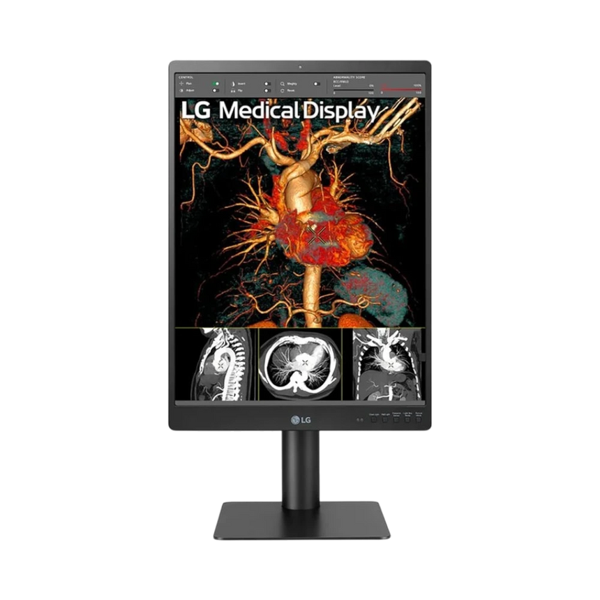 LG 21HQ513D 21.3" 3:4 60Hz 3MP IPS Diagnostic Monitor — Being Shipped