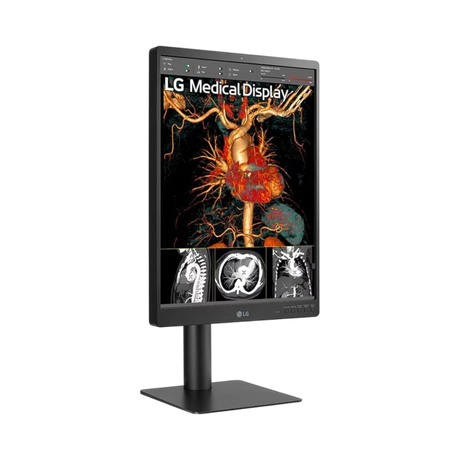 LG 21HQ513D 21.3" 3:4 60Hz 3MP IPS Diagnostic Monitor — Being Shipped