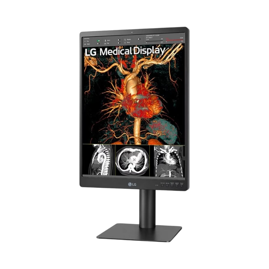 LG 21HQ513D 21.3" 3:4 60Hz 3MP IPS Diagnostic Monitor — Being Shipped