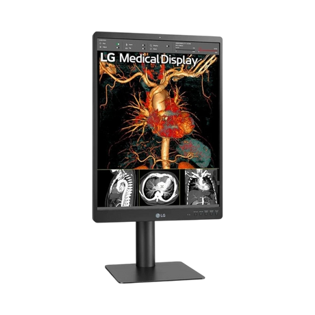 LG 21HQ513D 21.3" 3:4 60Hz 3MP IPS Diagnostic Monitor — Being Shipped