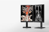 LG 21HQ513D 21.3" 3:4 60Hz 3MP IPS Diagnostic Monitor — Being Shipped