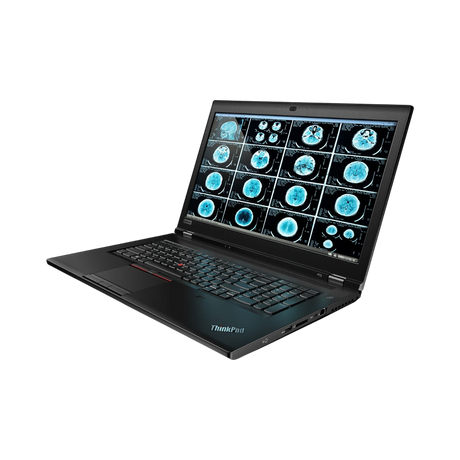 Lenovo ThinkPad P73 17.3" Laptop, Intel Core i7-9750H, NVIDIA Quadro P620, 16GB DDR4 RAM, 512GB SSD — Being Shipped